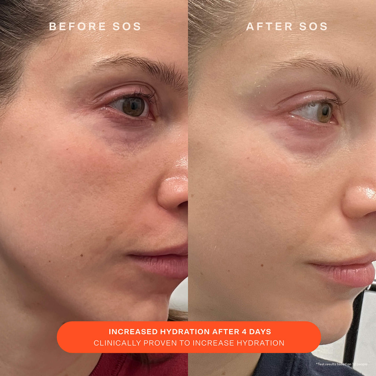 SOS Recovery Cream H2