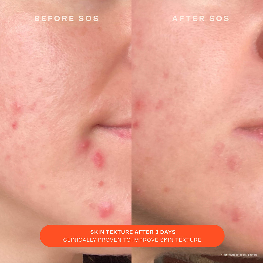 SOS Recovery Cream H2