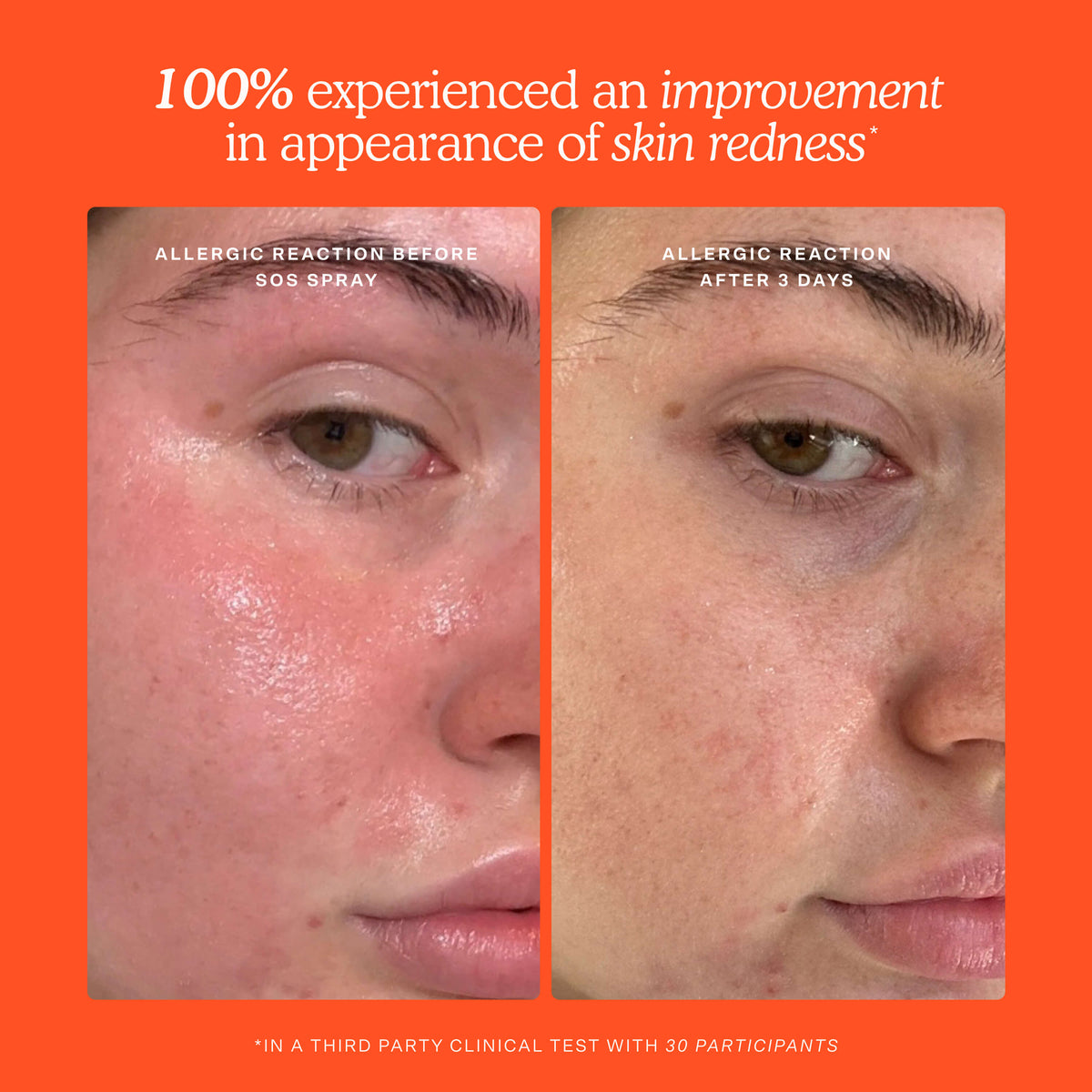 SOS Skincare Minis Kit H5
