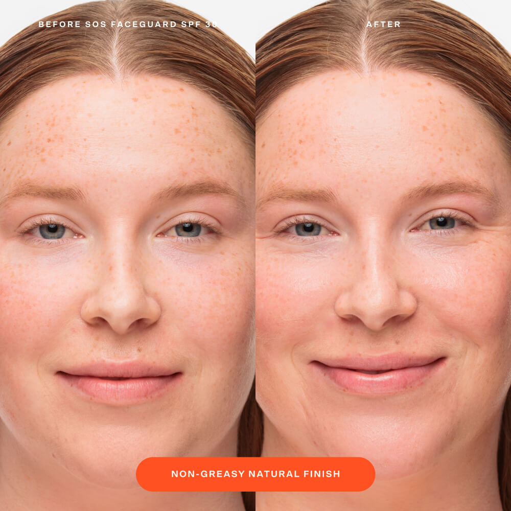 SOS FaceGuard™ SPF 30 Sunscreen PA+++ X5