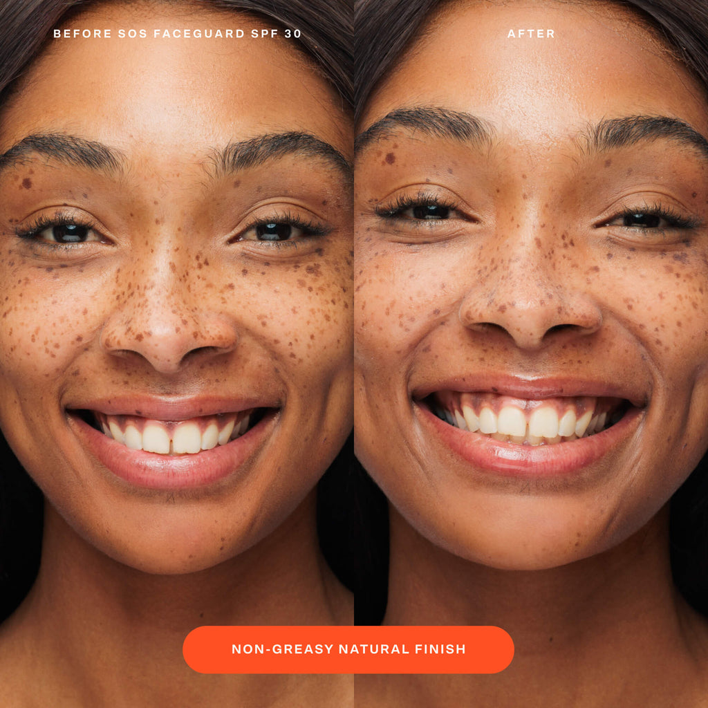 SOS FaceGuard™ SPF 30 Sunscreen PA+++ X5