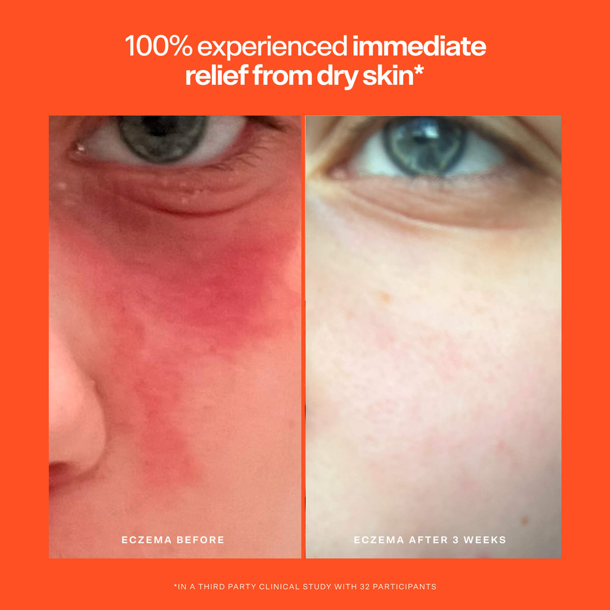 SOS Rescue Serum U5