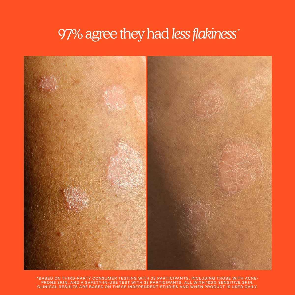 SOS Rescue + Relief Body Wash Treatment L8